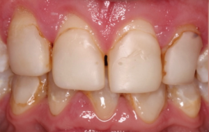 patient before image