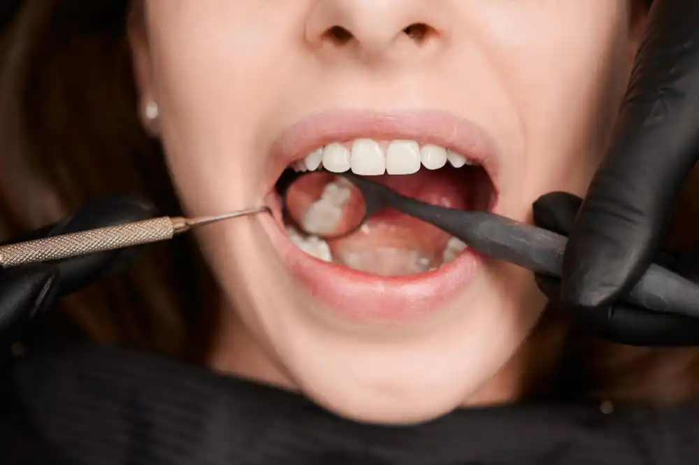 dental patients mouth