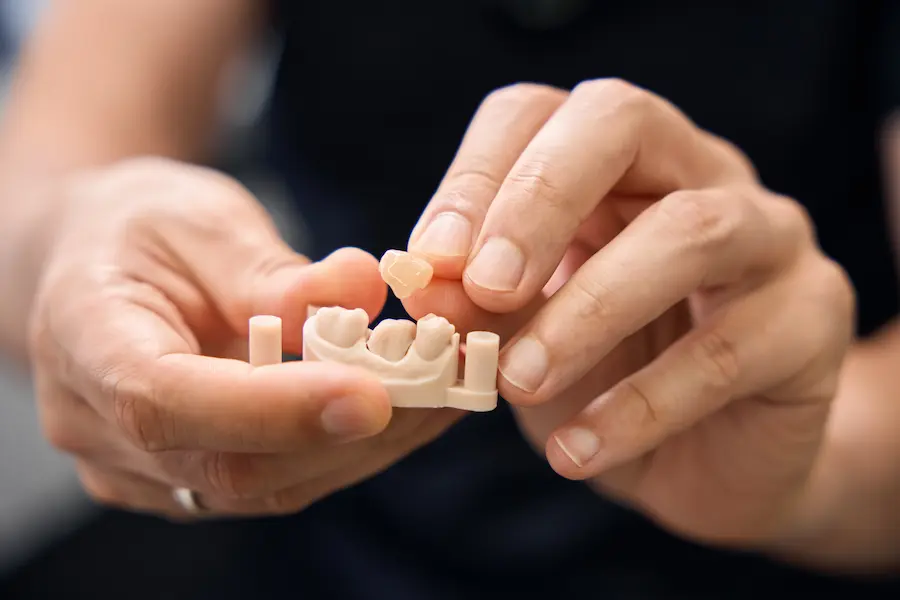 Dental Professional Working with Tooth Model