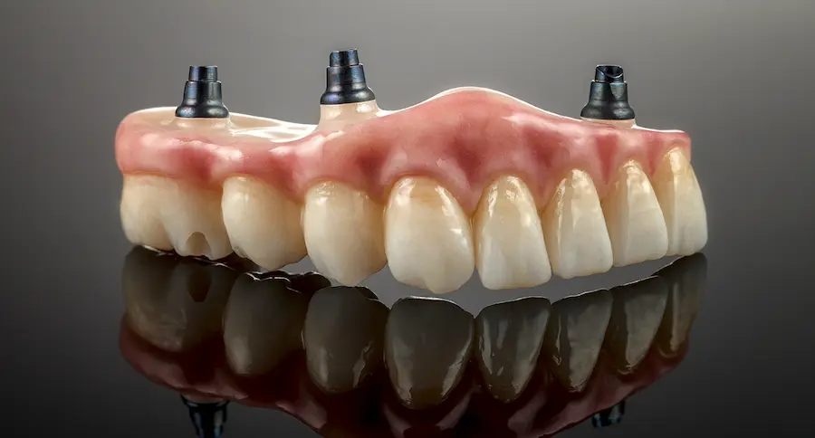 Implant Supported Denture on Dark Reflective Background